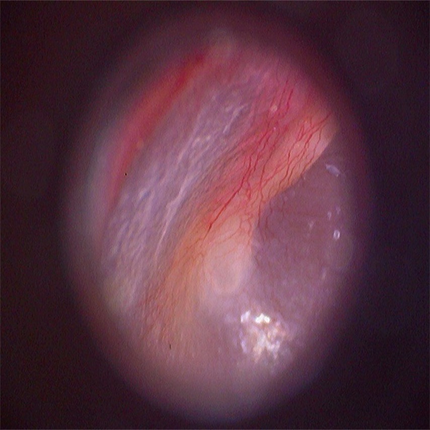 D E500-4  Thumbnail0