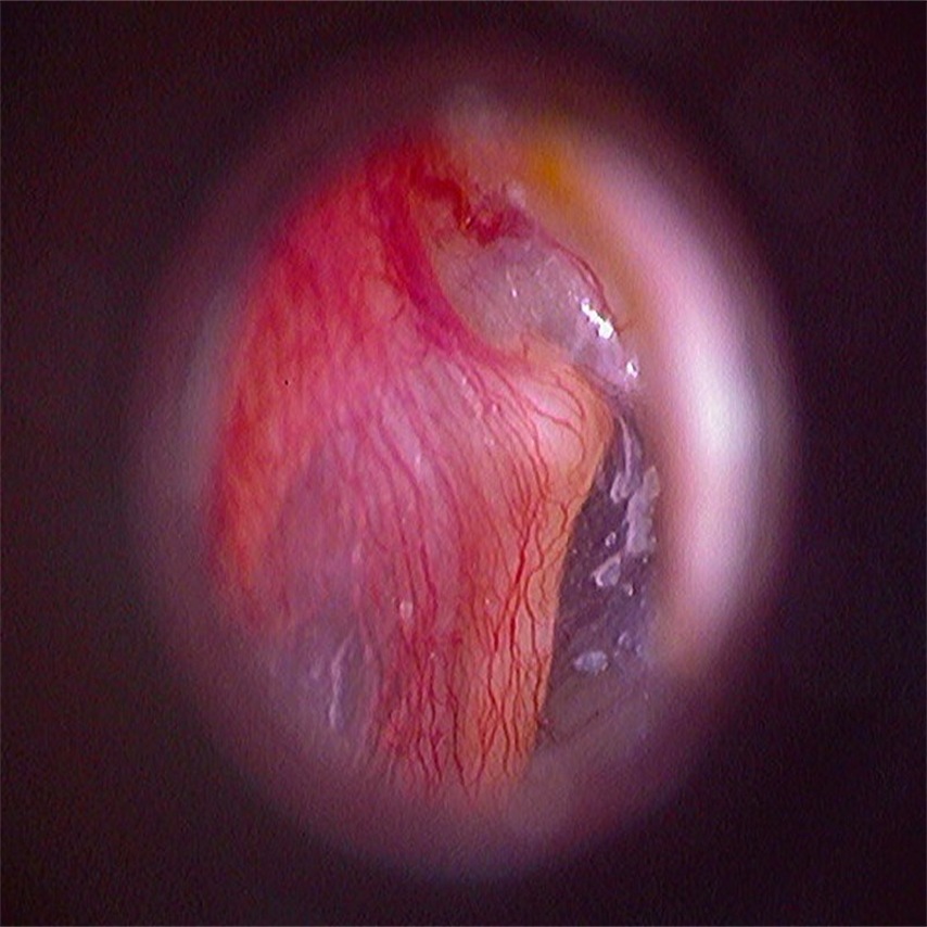 D E500-5  Thumbnail0