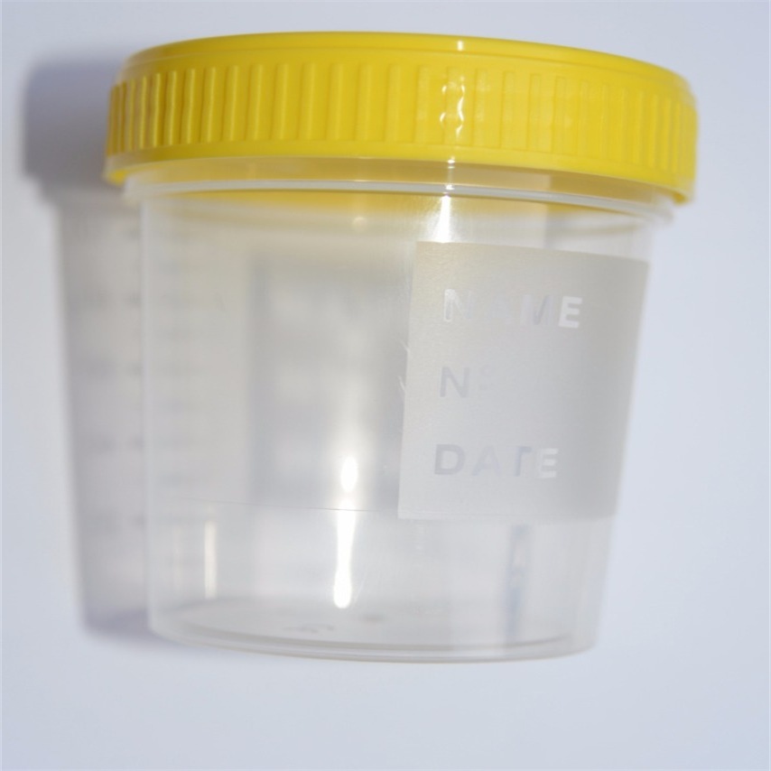 Urine Test Cups Sterile [100 cups]